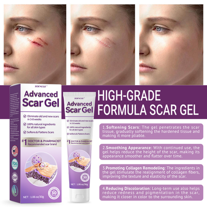 【Limited time discount sale🔥】 Advanced Scar Gel-🏆 Specialized for keloid management🏆