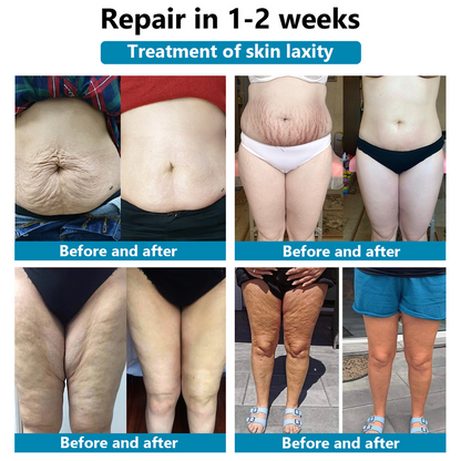 Luxurious Repair & Firming Serum | 🔥Last Day Discount: 80% OFF🔥