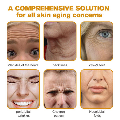 Last Day Promotion 80% OFF - ✨Furzero™ Bee Venom Wrinkle Removal Cream